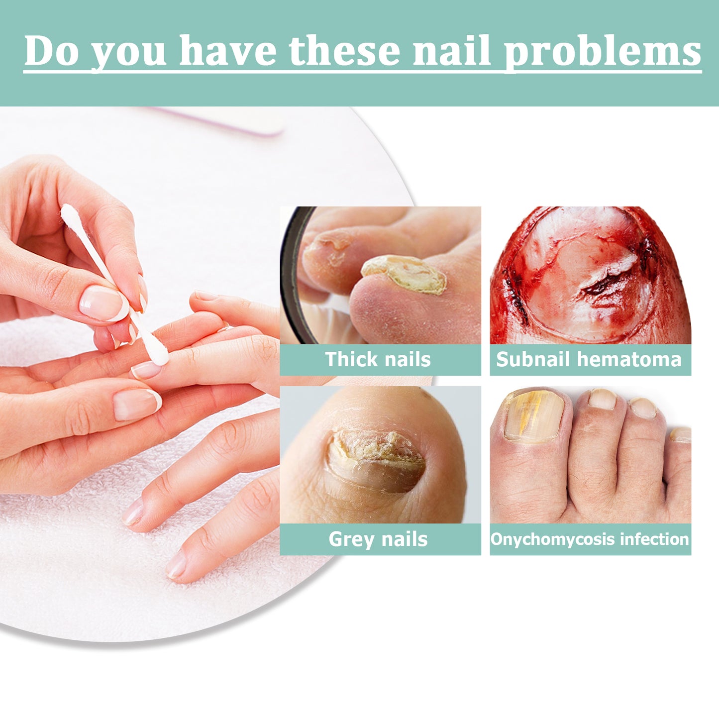 Nail Brightening Care