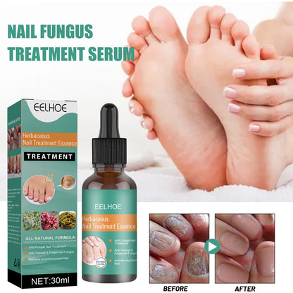Herbaceous Nail Repair Essence