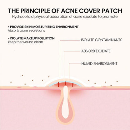 Decorative Acne Patches (200 pcs)