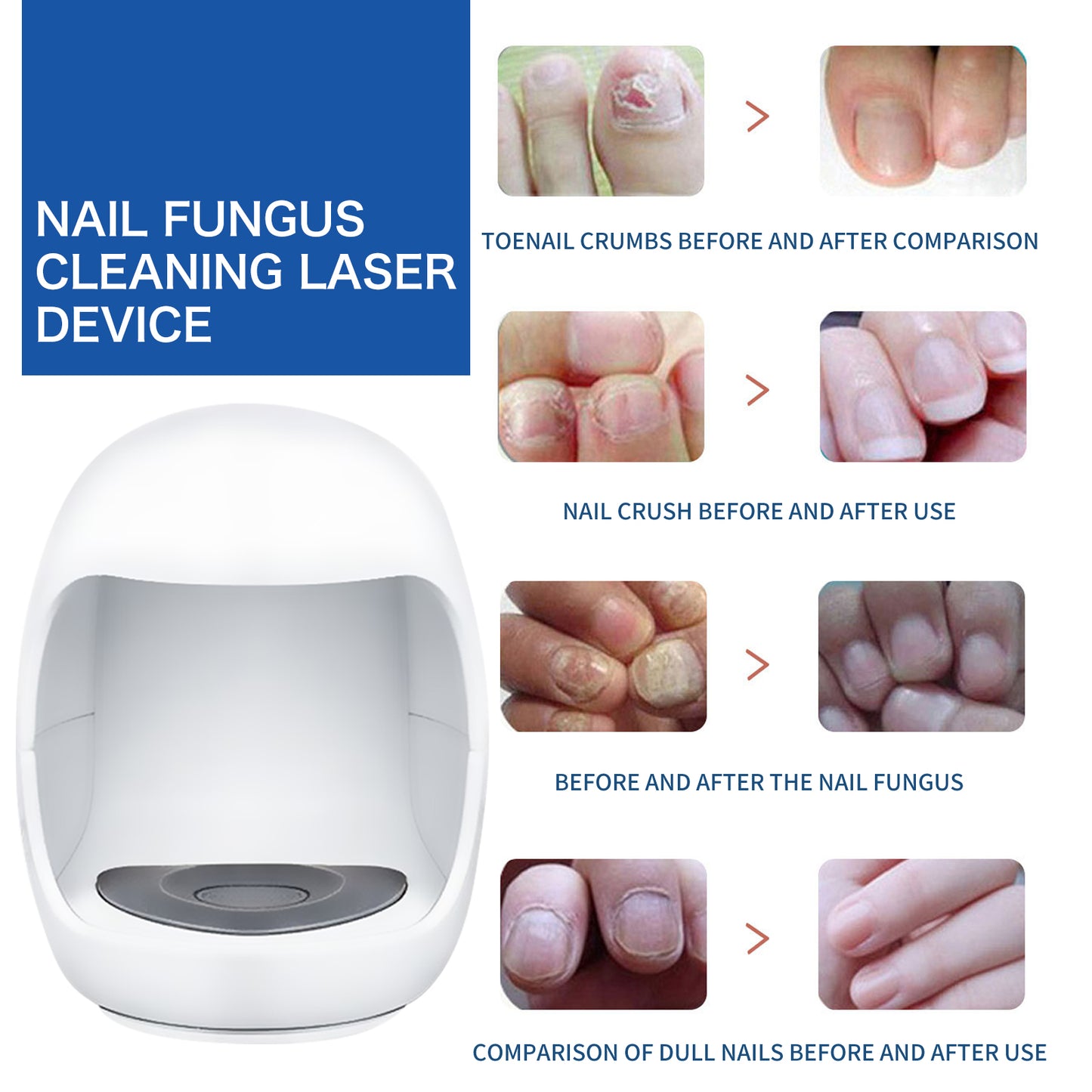 Nail Care Phototherapy Device