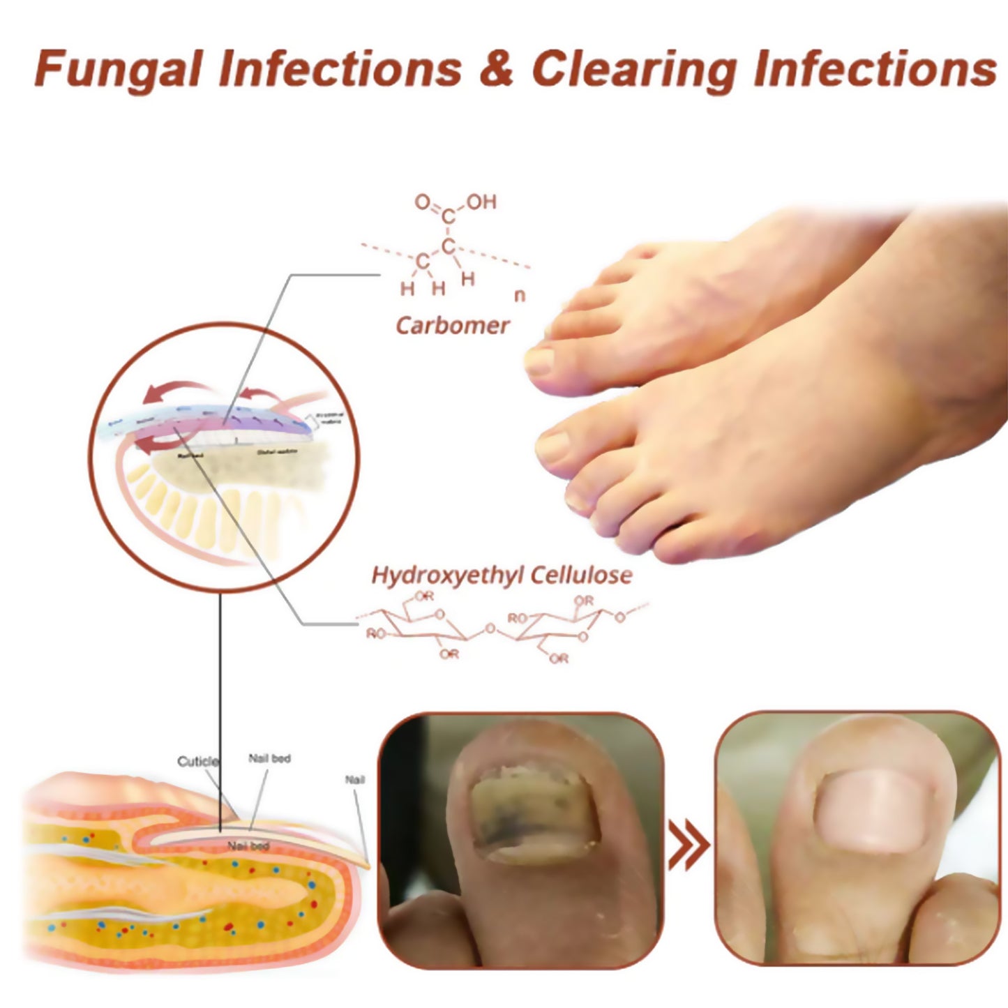 Nail Care Phototherapy Device